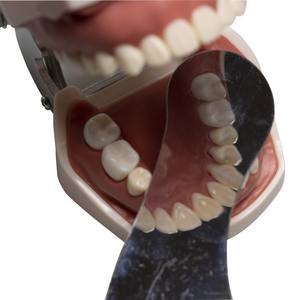 Quatre pièces professionnelles en acier inoxydable dentaire pour la photographie intra-orale, réflecteur orthodontique - Product Image 4