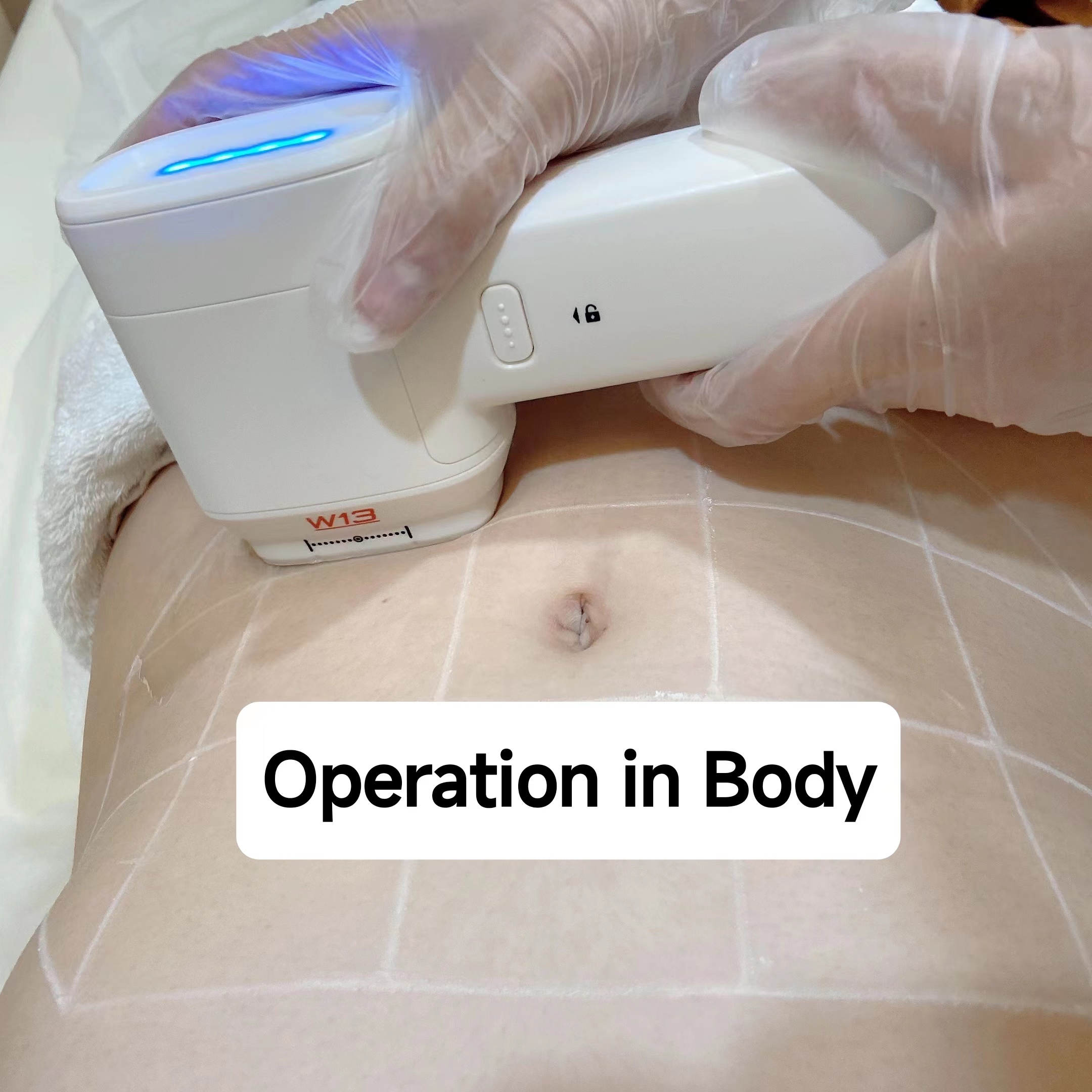 2023 New 8D HIFU Ultrasound Skin Tightening Machine Hifu Therapy For Face And Neck Lifting
