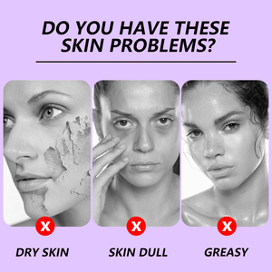 Mascarilla Facial Burbujeante con Extracto de Perilla y Agua Carbonatada, Hidratante, para Todo Tipo de Piel, Marca Privada OEM - Product Image 4