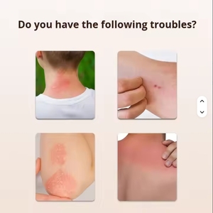 Miao ferita alleato 15g Post-Trauma riparazione a base di erbe Multi-Purpose denti sbiancamento accessorio <span class=keywords><strong>per</strong></span> ustioni punti pelle lacrime - Product Image 4