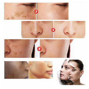 20.000 mg <span class=keywords><strong>L</strong></span>-Glutathion Kräuter ergänzungen Anti-Aging & Beauty Kapseln für Erwachsene Nicht für Schwangere - Product Image 5