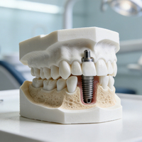Modelo Dental de Resina Personalizado para Demostración, Estudio y Enseñanza, Modelo de Dientes para Educación y Demostración, Tipodonto
