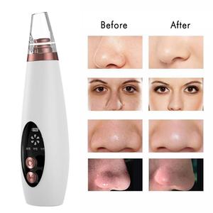6 In 1 dispositivo di rimozione dei punti neri elettrico detergente per pori aspirapolvere aspirazione dell'acne strumento ricaricabile per la pulizia profonda del viso con 6 ventose - Product Image 2