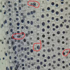 Juego de Portaobjetos de Mitosis de Células de la Punta de la Raíz de <span class=keywords><strong>Cebolla</strong></span> (2N=16) Observa el Arreglo Mitótico de las Células <span class=keywords><strong>en</strong></span> la Zona Meristática de la <span class=keywords><strong>Cebolla</strong></span> - Product Image 5