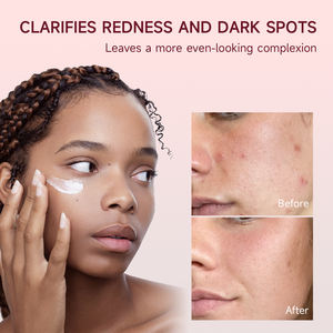 Crema Reparadora Iluminadora Correctora de Manchas Oscuras con Ácido Sazelaico, Ácido Tranexámico y Niacinamida para el Cuidado de la Piel y el Acné, Venta al por Mayor de Cosméticos Coreanos - Product Image 5