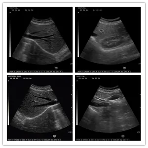 Mesin Ultrasound ultrasonik portabel Sonar medis JM-806G