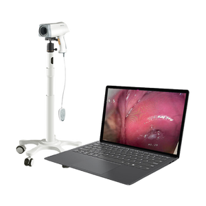 गिरी KN-2200 0.8MP स्त्री रोग स्त्री रोग वीडियो Colposcope कैमरा पूर्ण HD 1080p इलेक्ट्रॉनिक colposcope - Product Image 4