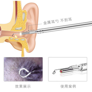 Ear Spoon Accessory Kit With Pc Transparent Head For 3.9mm Ear Endoscope Cleaning Supplies - Product Image 3