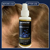 Haarwuchs-Förderungsspray 5% Haarwuchslösung 60ml Flüssiges Tonikum-Serum Organisch Nährend für Lockiges/Schädigtes Haar und Bart für Erwachsene