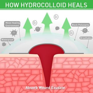 Parches Hidrocoloides Flexibles Adhesivos, Seguros para la Piel y Resistentes al Agua, para Uso Diario - Product Image 4