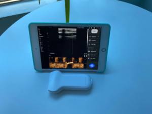 Perbaikan Probe <span class=keywords><strong>Ultrasound</strong></span> Nirkabel dengan Probe Yang Dapat Dilepas - Product Image 5
