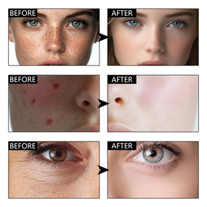 Sérum pour la peau à la niacinamide 35% - Sérum super puissant éclaircissant et hydratant pour le visage - Unifie le teint - Absorption rapide - Convient à tous les types de peau - Product Image 5