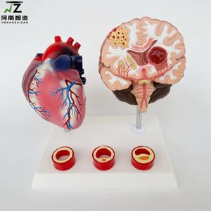 Maniquí de Demostración para la Enseñanza de Enfermedades Cardiovasculares y Cerebrovasculares Humanas, con Edad y Tamaño Real, en PVC Avanzado - Product Image 3