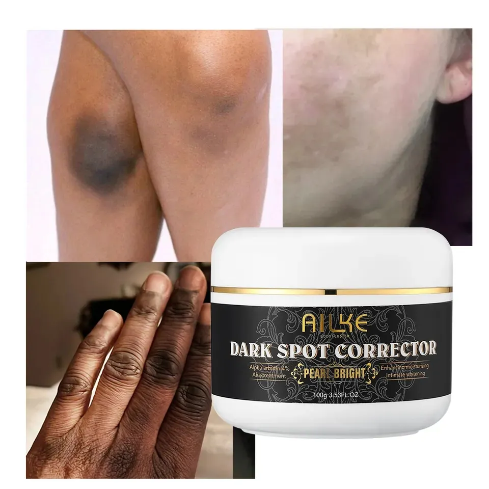 Private label Black Pearl Beauty Skin Care Whitening Underar Knuckles Body Cream Nicotinamide Removal Dark Spot Bleaching Cream
