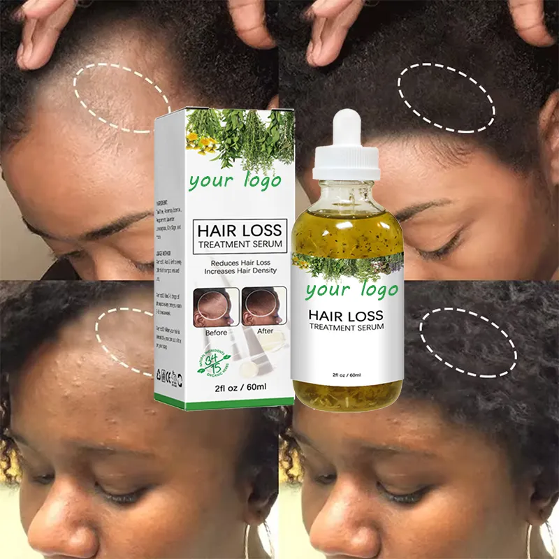 Óleo de crescimento capilar 100% natural de marca própria soro Rosemary Menta Couro cabeludo fortalecedor óleo de alecrim crescimento capilar