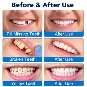 Prothèses dentaires pour hommes et femmes, fausses dents moulées avec couvercles supérieurs et inférieurs, teinte naturelle, fausses dents et facettes - Product Image 5
