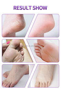 Prodotti unici per la vendita di prodotti unici per la vendita all'ingrosso bambino piede maschera esfoliante piedi lungo maschera spa pedicure calzini - Product Image 4