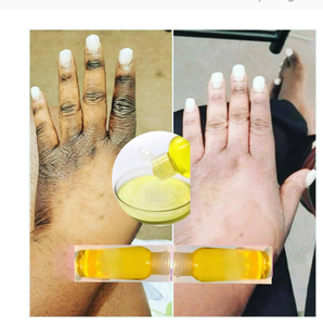 Aceite Exfoliante <span class=keywords><strong>Extra</strong></span> Fuerte de Marca Privada, Aceite Exfoliante Amarillo Blanqueador - Product Image 1