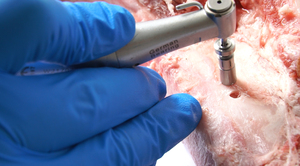 Instrumento de Implante <span class=keywords><strong>Dental</strong></span> para Fragmentos Ósseos e Enxertos Ósseos - Product Image 4