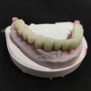 Metallo ceramico dentiere produttore di prodotti dentali Custom Pfm corone ponti con rosa gomma porcellana - Product Image 3