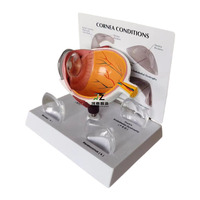 Modèle d'anatomie de l'œil humain Conditions de la cornée en PVC pour l'éducation médicale pour les écoles et les hôpitaux