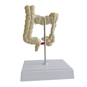 Modèle pathologique du côlon humain, modèle anatomique de l'intestin large - Product Image 4