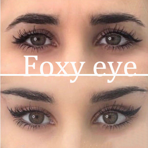 S REJEON Prix d'usine Qualité stable Fils PDO Fox Eye Cog 23G/21G/19G 60mm/100mm pour la formation en esthétique médicale - Product Image 2