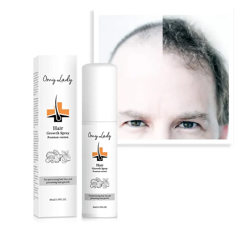 منتجات صالون الشعر ماركة خاصة مجانية علاج للقشرة وفقدان الشعر - لكل أنواع الشعر لعلاج تساقط الشعر