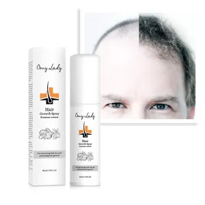 free private label salon products anti-dandruff anti hair loss- for all hair types sample treatment of hair loss