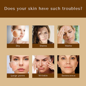 Corée 24K Or Vgo Vitamine C Sérum Visage <span class=keywords><strong>Niacinamida</strong></span> Soins de la Peau Pour Éclaircir l'Huile - Product Image 5