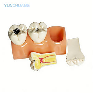 แบบจำลองฟันที่ถอดประกอบได้ 4 แบบ สำหรับการศึกษาเรื่องโรคฟัน แบบจำลองฟันสำหรับการศึกษา สามารถถอดประกอบได้ อเนกประสงค์ สำหรับการดูแลสุขภาพช่องปาก - Product Image 2