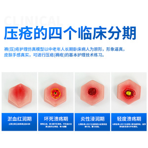 Modèle de soins des escarres à pression en plusieurs étapes, modèle pédagogique pour les soins aux personnes âgées et modèle de formation aux soins des escarres à pression en quatre étapes - Product Image 5