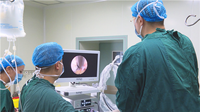 Caméra endoscopique OM-822C, sortie vidéo 1080p CMOS