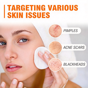 Hot Sales Facial Blemish Care Cream Moisturizing Facial Cream Improves Blemish Marks Skin Care - Product Image 4