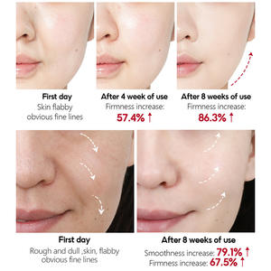 โทนเนอร์อาร์บูตินไวท์เทนนิ่งเพิ่มความกระจ่างใสและเพิ่มความชุ่มชื้นลดจุดด่างดำจากสิว - Product Image 5