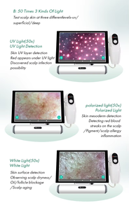 11-Inch HD Scalp Skin Detector & 4-Spectrum Hair Follicle Analyzer 200X Magnification 2-Year Warranty Salon Home Use - Product Image 5