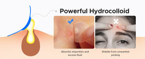 Fast-Acting Hydrocolloid Acne <strong>Patches</strong>, Reduce Redness and <strong>Draw</strong> Out Impurities Overnight - Product Image 5