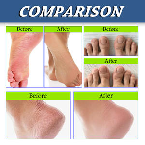 Spray pour les pieds South Moon, anti-odeur, antibactérien, ingrédients naturels, hautement efficace - Product Image 4