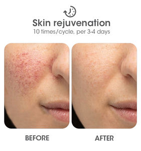 Dispositivo Portátil de Depilación Láser IPL para Uso Doméstico, Máquina de Depilación Permanente para Mujeres y Hombres, Segura e Indolora - Product Image 4