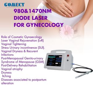 Máquina Láser de Rejuvenecimiento Vaginal de 980nm con Buen Efecto, Tecnología Avanzada de Lipólisis, Tratamiento con Láser de 980nm y 1470nm - Product Image 2
