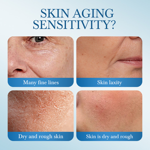<span class=keywords><strong>Crema</strong></span> Facial Hidratante con <span class=keywords><strong>Urea</strong></span> al 9.99% OEM, <span class=keywords><strong>Crema</strong></span> Antienvejecimiento, Calmante y Revitalizante, Reafirmante para Piel Sensible, Fabricante Personalizado - Product Image 3