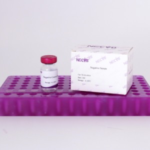 Chất lượng cao kiểm soát tiêu cực huyết thanh cho <span class=keywords><strong>Elisa</strong></span>/ihc-động vật miễn phí, vô trùng, số lượng lớn đơn đặt hàng có sẵn - Product Image 3