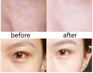 Crema de noche y de día Retinol Essence Loción antienvejecimiento Blanqueamiento Reafirmante Iluminador e hidratante Crema de día para el cuidado de la piel - Product Image 6