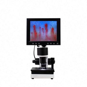 Nail Fold Blood Test <span class=keywords><strong>Digital</strong></span> Biológico Capilar Verificação Microcirculação Checkup Microscópio - Product Image 1