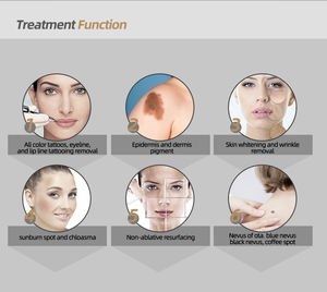 Máquina <span class=keywords><strong>de</strong></span> Eliminación <span class=keywords><strong>de</strong></span> Pecas con Láser <span class=keywords><strong>de</strong></span> Picosegundos ADSS, Venta Caliente, Blanqueamiento <span class=keywords><strong>de</strong></span> Piel con Láser <span class=keywords><strong>de</strong></span> 532 nm y 1064 nm para Salón Comercial - Product Image 5