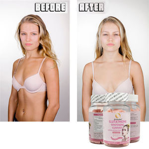 Penjualan Terbaik Glutathione pemutih Gummies meringankan bahkan warna kulit suplemen makanan - Product Image 2