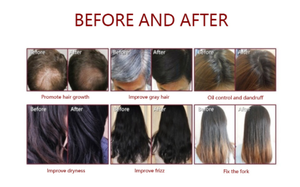 Professional Diode Hair Growth <b>Machine</b> Hair Growth <b>Massage</b> <b>Machine</b> with Hair Analyzer for Salon - Product Image 3