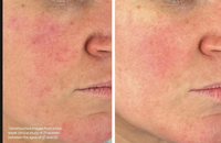 Sérum Peptidique Anti-Âge Raffermissant et Éclaircissant au Collagène et Céramide, Niacinamide pour Hydratant Visage Anti-Rides Marque Blanche