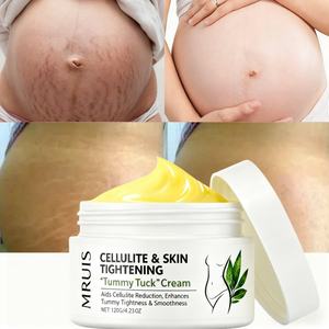 <span class=keywords><strong>Crema</strong></span> <span class=keywords><strong>Para</strong></span> eliminar estrías de 120G <span class=keywords><strong>para</strong></span> mujeres <span class=keywords><strong>embarazadas</strong></span>, reparación de la piel, cuidado de la piel, <span class=keywords><strong>crema</strong></span> <span class=keywords><strong>para</strong></span> eliminar estrías de abdominoplastia <span class=keywords><strong>para</strong></span> el cuerpo - Product Image 1