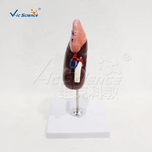 Modelo de Estructura Renal Humana con Glándula Adrenal, Espécimen de PVC para Entrenamiento en Laboratorio de Anatomía, <span class=keywords><strong>Nefrología</strong></span> <span class=keywords><strong>y</strong></span> <span class=keywords><strong>Urología</strong></span>, CE/ISO/ROHS/CNAS - Product Image 2